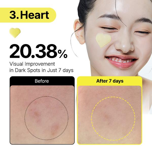 Heart patch: 20.38% visual improvement in dark spots in 7 days