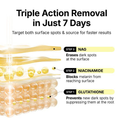 Triple action removal in just 7 days: Glutathione, Niacinamide, NAG