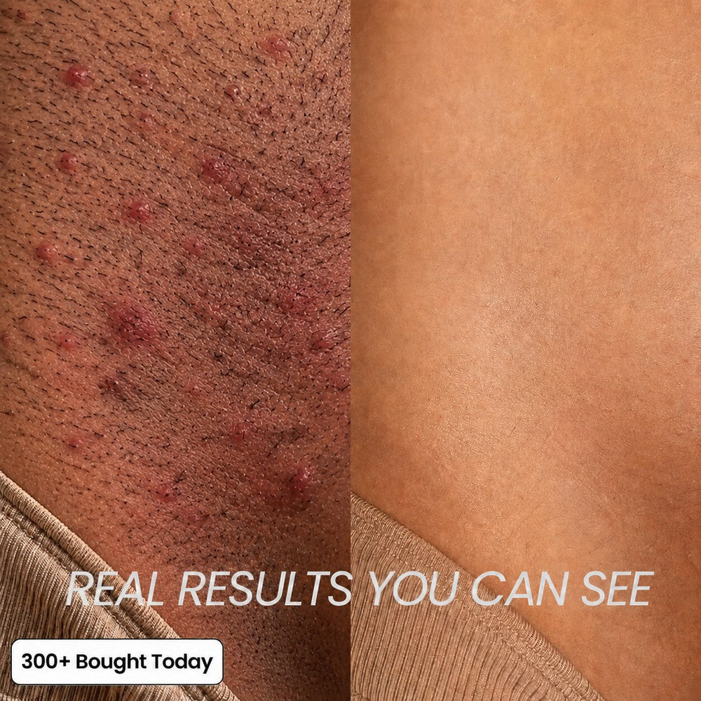 A smarter way to slow regrowth