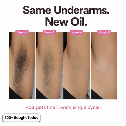 Anti-Hair Growth Oil